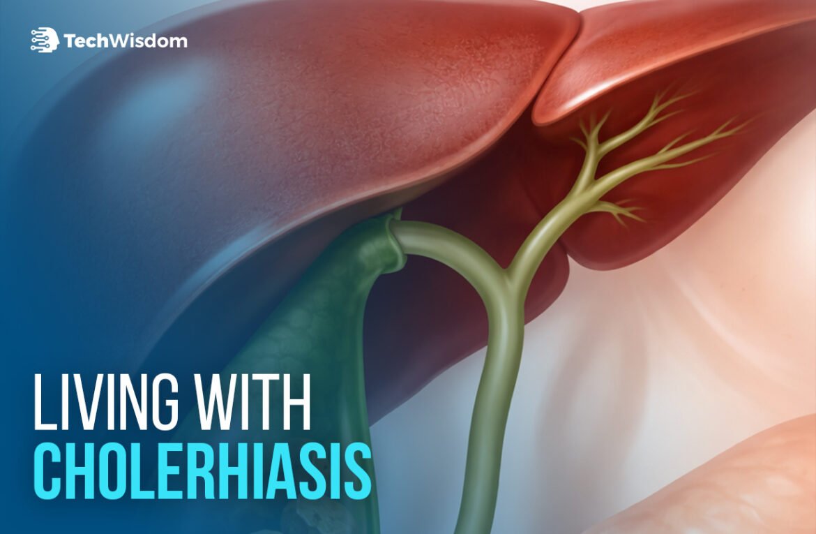 Living With Cholerhiasis: Symptoms, Causes, and When to See a Doctor