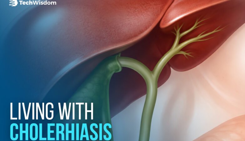 Living With Cholerhiasis